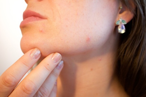 Visitas al dermatólogo: los cinco motivos más frecuentes