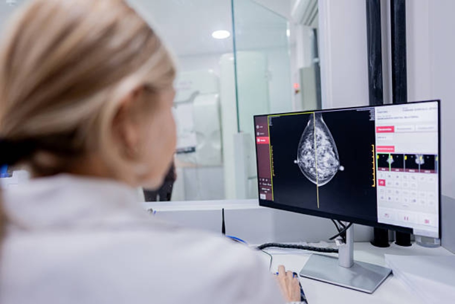 El cáncer de mama antes de los 40 años plantea retos relacionados con la fertilidad